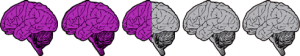 twoandhaldbrains