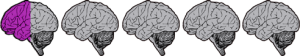 halfbrain